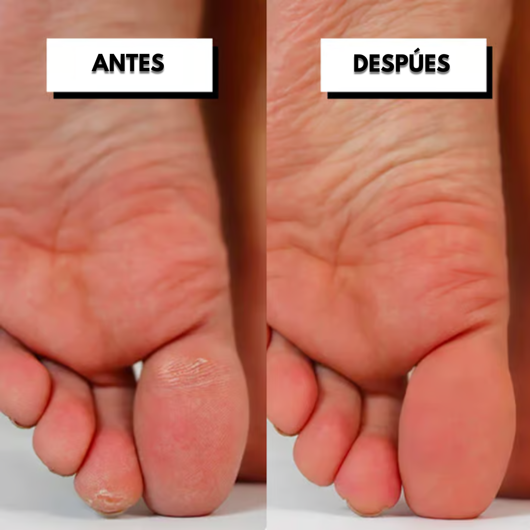 Pedicuure™: Removedor de Callos Electrico