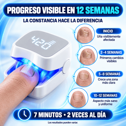 DermoLux | Laser Antifungico Adios Hongos