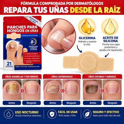 DermaPatch | Parche Antifungico Para Uñas