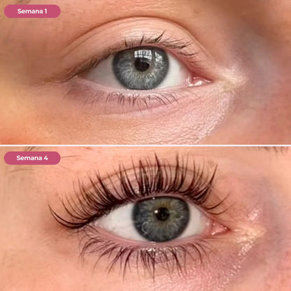 LashBoost: Serum Alargador de Pestañas y Cejas ✨